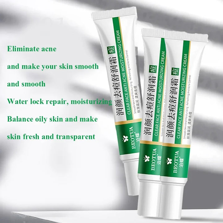 Herbal Acne Treatment Cream – Scar & Pore Remover, Oil Control & Whitening
